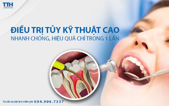 Điều trị tủy răng hiệu quả chỉ trong 1 lần hẹn tại Bệnh viện Thái Thượng Hoàng
