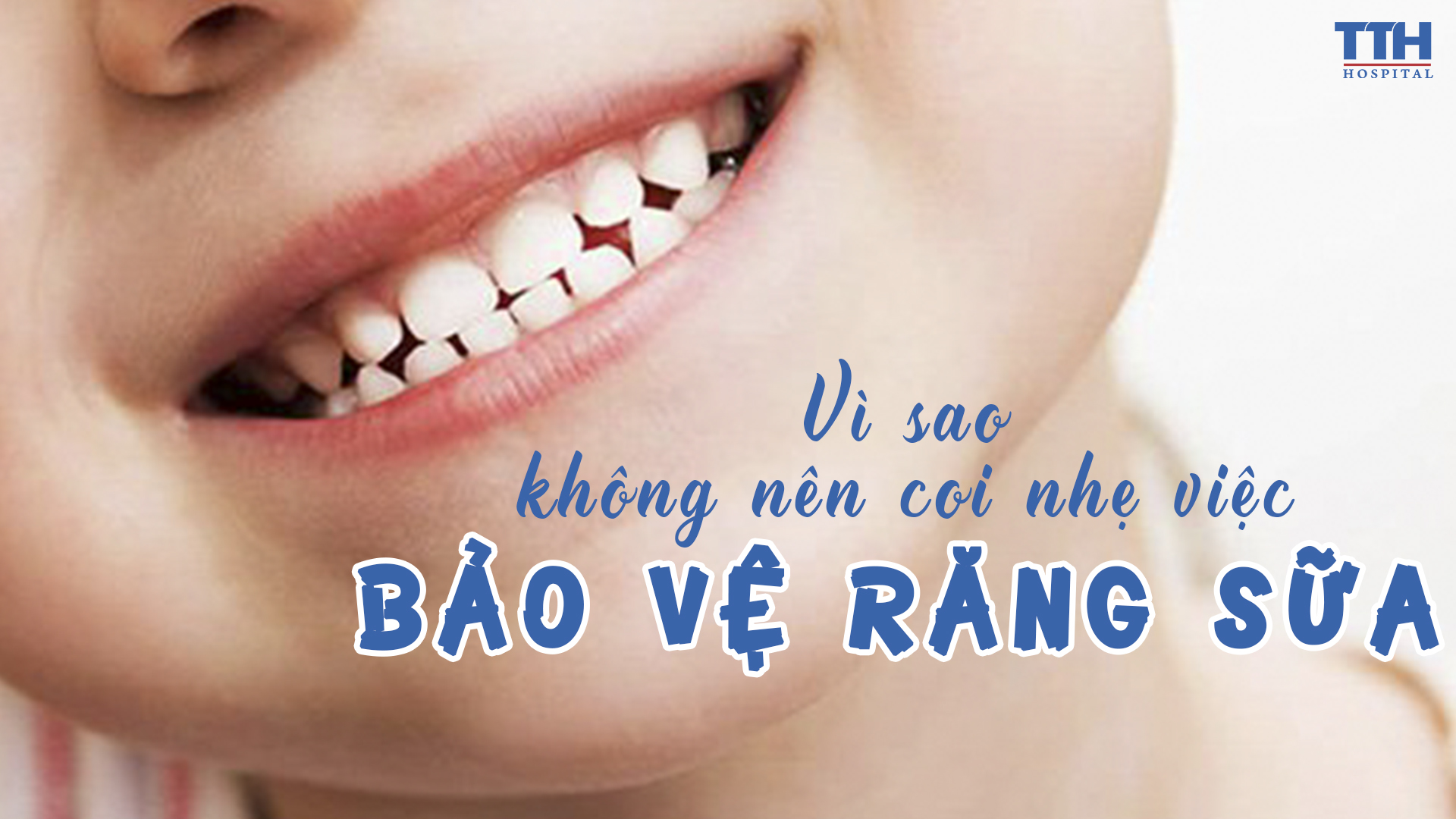 VÌ SAO KHÔNG NÊN COI NHẸ VIỆC BẢO VỆ RĂNG SỮA