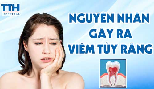 Nguyên nhân gây ra viêm tủy răng