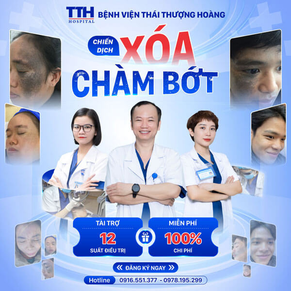 Chiến dịch xóa chàm bớt miễn phí