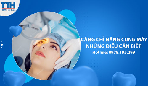 Căng chỉ nâng cung mày