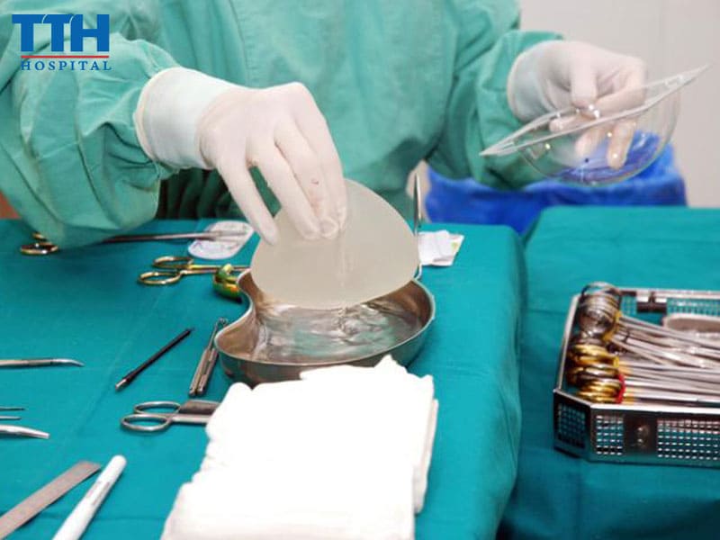 Điều gì có thể xảy ra với một ca nâng ngực?