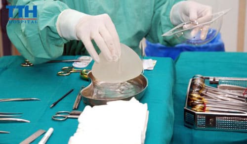 Điều gì có thể xảy ra với một ca nâng ngực?