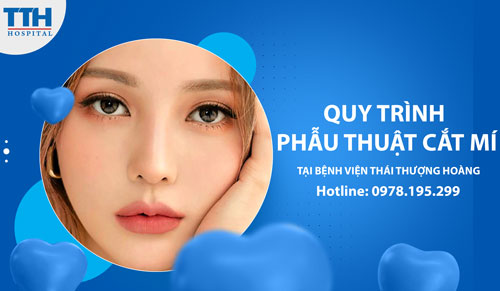 Quy trình phẫu thuật cắt mí tại bệnh viện Thái Thượng Hoàng