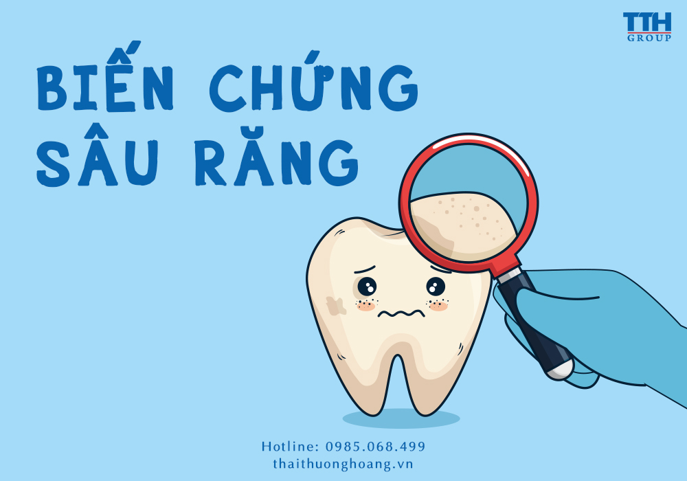 BIẾN CHỨNG CỦA SÂU RĂNG CÓ THỂ GẶP PHẢI