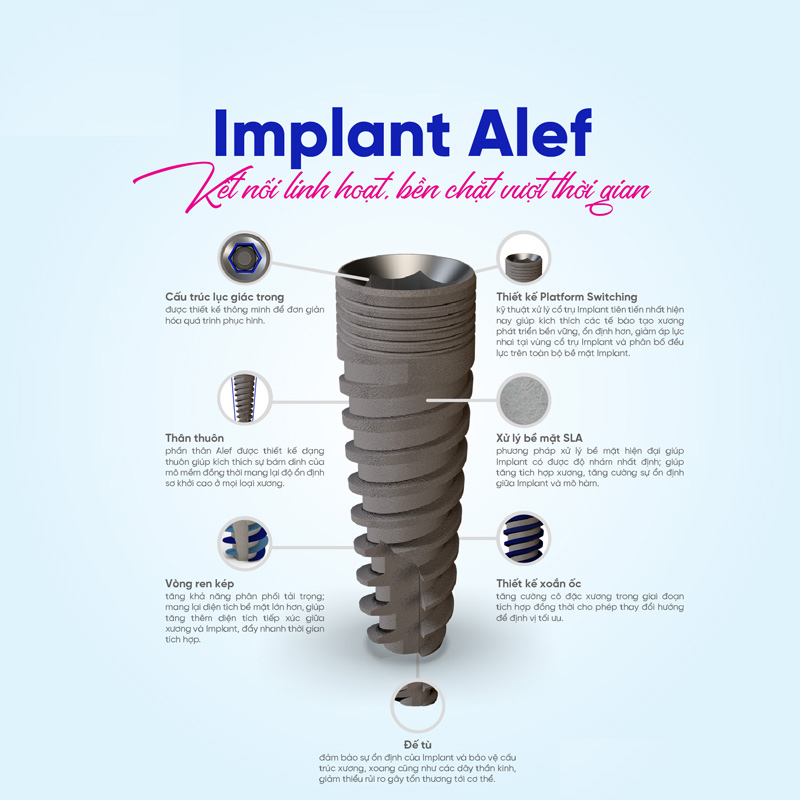 Trụ Implant Alef - Giải Pháp Hoàn Hảo Cho Tình Trạng Mất Răng