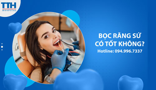 Bọc răng sứ có tốt không?