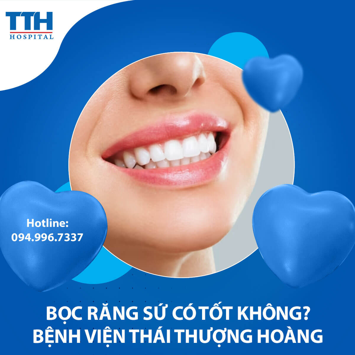 Bọc răng sứ có tốt không?