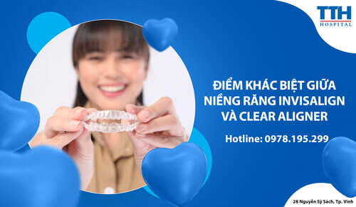 Điểm khác biệt giữa niềng răng Invisalign và niềng răng Clear Aligner