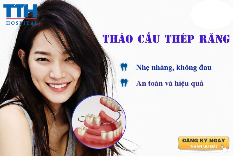 Phương pháp tháo cầu thép răng