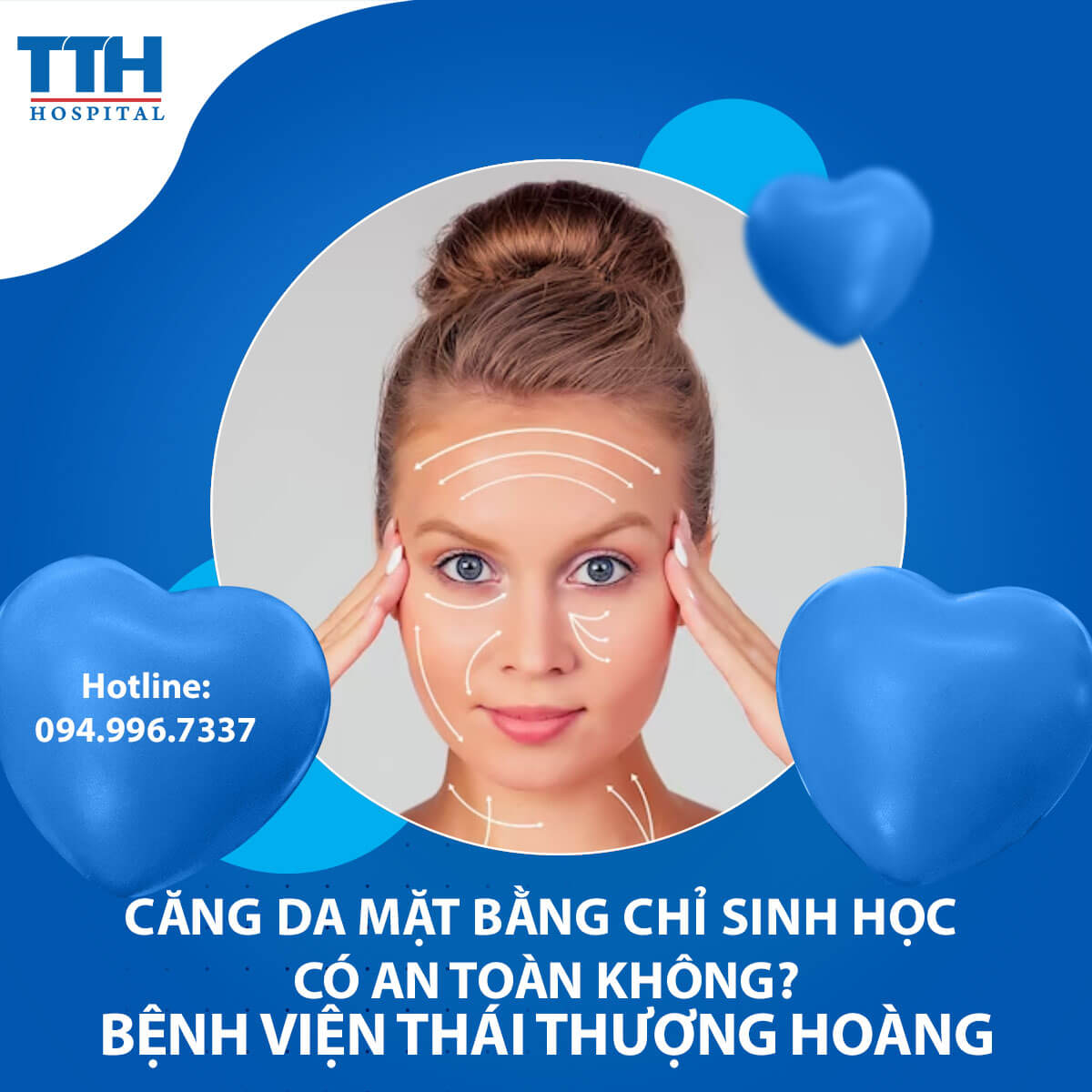 Căng da mặt bằng chỉ sinh học có an toàn không?