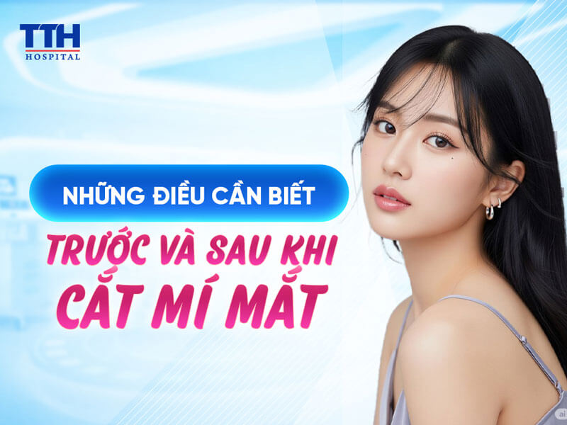 CẮT MÍ MẮT BAO LÂU THÌ HỒI PHỤC?
