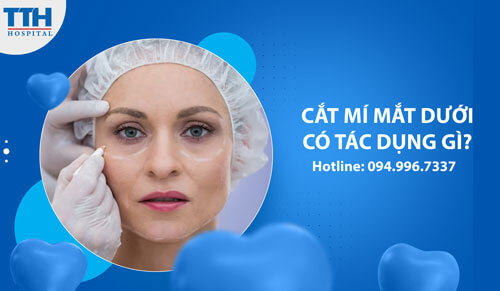 Cắt Mí Mắt Dưới Có Tác Dụng Gì?