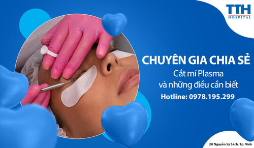 Cắt mí Plasma và những điều cần biết