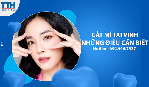 Cắt Mí Tại Vinh - Những Điều Cần Biết