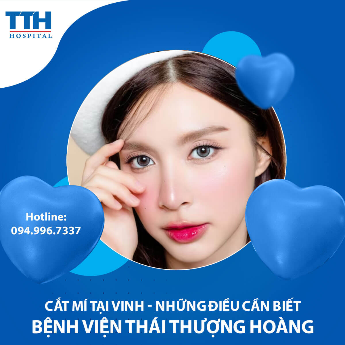 Cắt Mí Tại Vinh - Những Điều Cần Biết