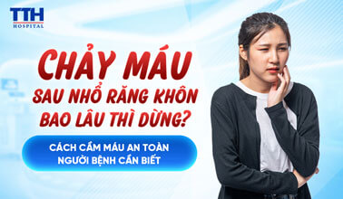 CHẢY MÁU SAU NHỔ RĂNG KHÔN BAO LÂU THÌ DỪNG?