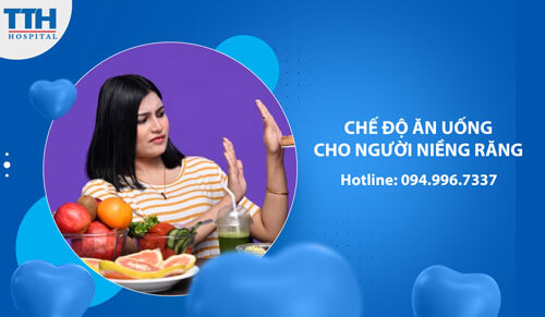 Chế Độ Ăn Uống Cho Người Niềng Răng