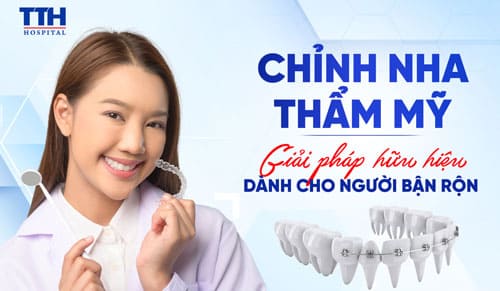 Chỉnh nha thẩm mỹ - Giải pháp hữu hiệu dành cho người bận rộn