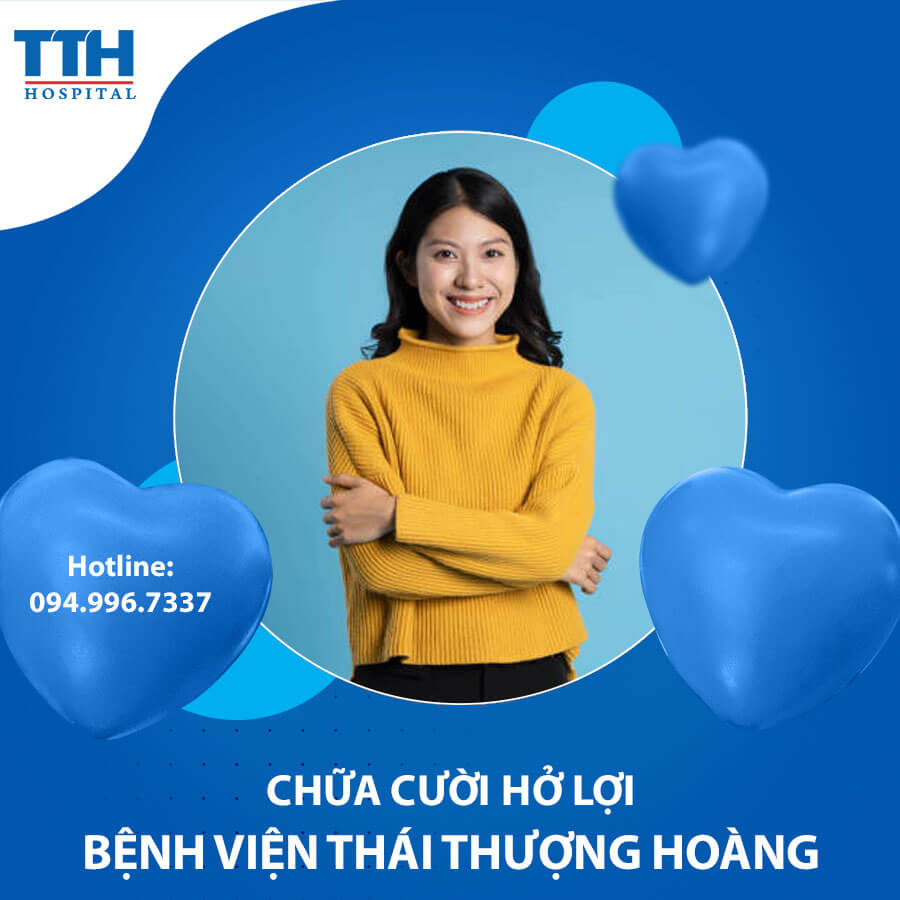 Chữa cười hở lợi