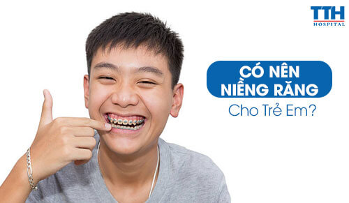 Có Nên Niềng Răng Cho Trẻ Em?