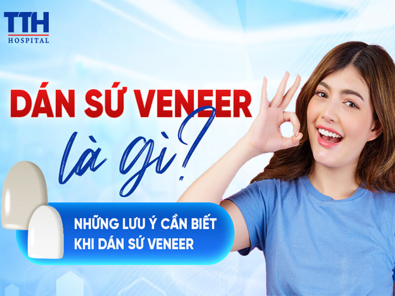 Dán sứ veneer là gì và những lưu ý cần biết khi dán sứ veneer