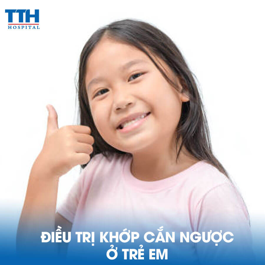 Điều Trị Khớp Cắn Ngược ở Trẻ Em