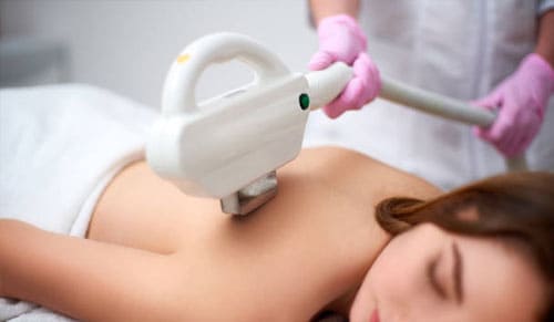 Điều trị mụn lưng bằng công nghệ ánh sáng sinh học IPL kết hợp Oxy Jet Aqua Peel