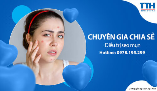 Điều trị sẹo mụn