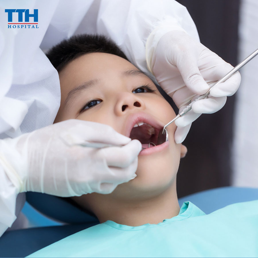 Dự Phòng Sâu Răng Cho Trẻ Em Có Thực Sự Cần Thiết?