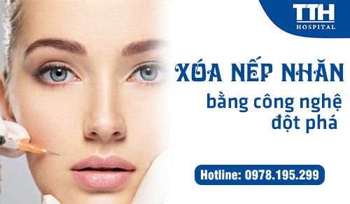 Xóa nếp nhăn bằng công nghệ đột phá