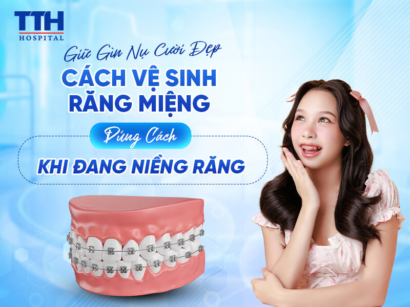 Giữ Gìn Nụ Cười Đẹp: Hướng Dẫn Vệ Sinh Răng Miệng Đúng Cách Khi Đang Niềng Răng
