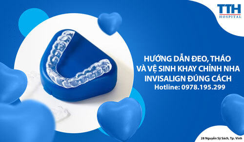 Hướng dẫn đeo, tháo và vệ sinh khay chỉnh nha invisalign đúng cách