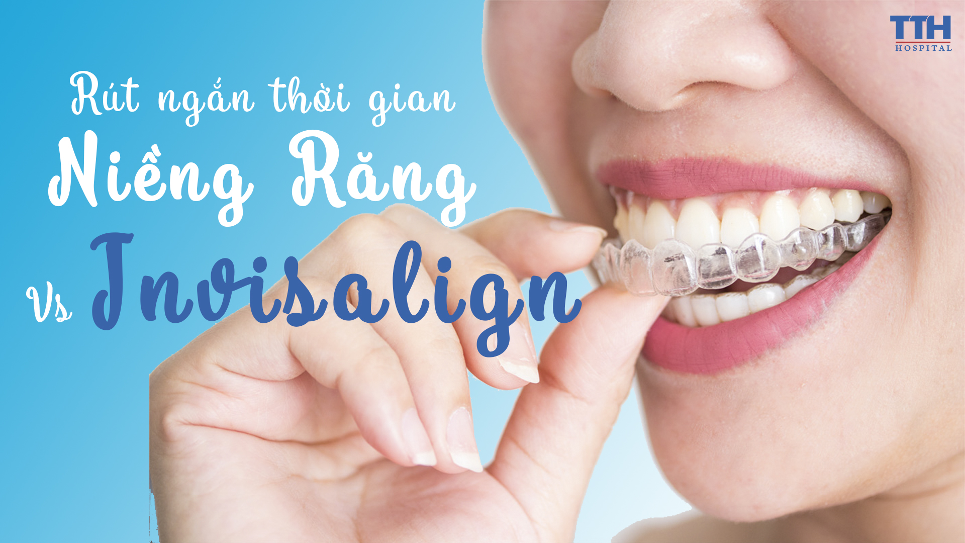 RÚT NGẮN THỜI GIAN NIỀNG RĂNG VỚI INVISALIGN