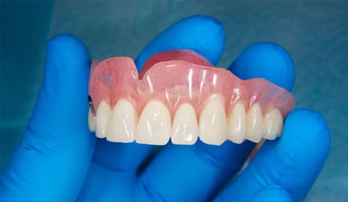 Kinh Nghiệm Bọc Răng Sứ Thẩm Mỹ Từ Chuyên Gia Chia Sẻ
