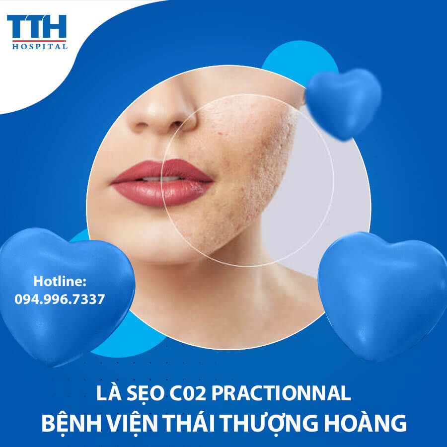 Là sẹo C02 Practionnal