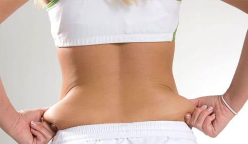 LOẠI BỎ “ĐỐNG” MỠ THỪA SAU TẾT - BẠN CHỌN HÚT MỠ HAY TẬP THỂ DỤC?