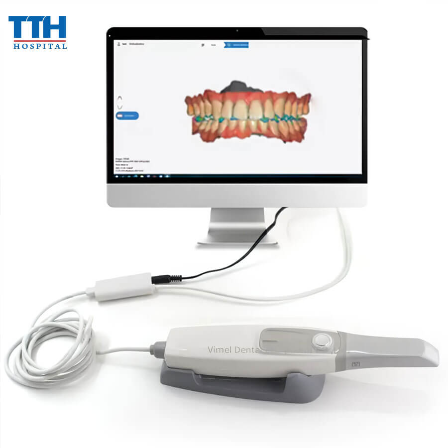 Máy Quét Aoral 3D Scanning: Công Nghệ Đột Phá Trong Chăm Sóc Răng Miệng