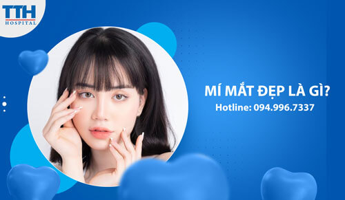 Mí Mắt Đẹp Là Gì?