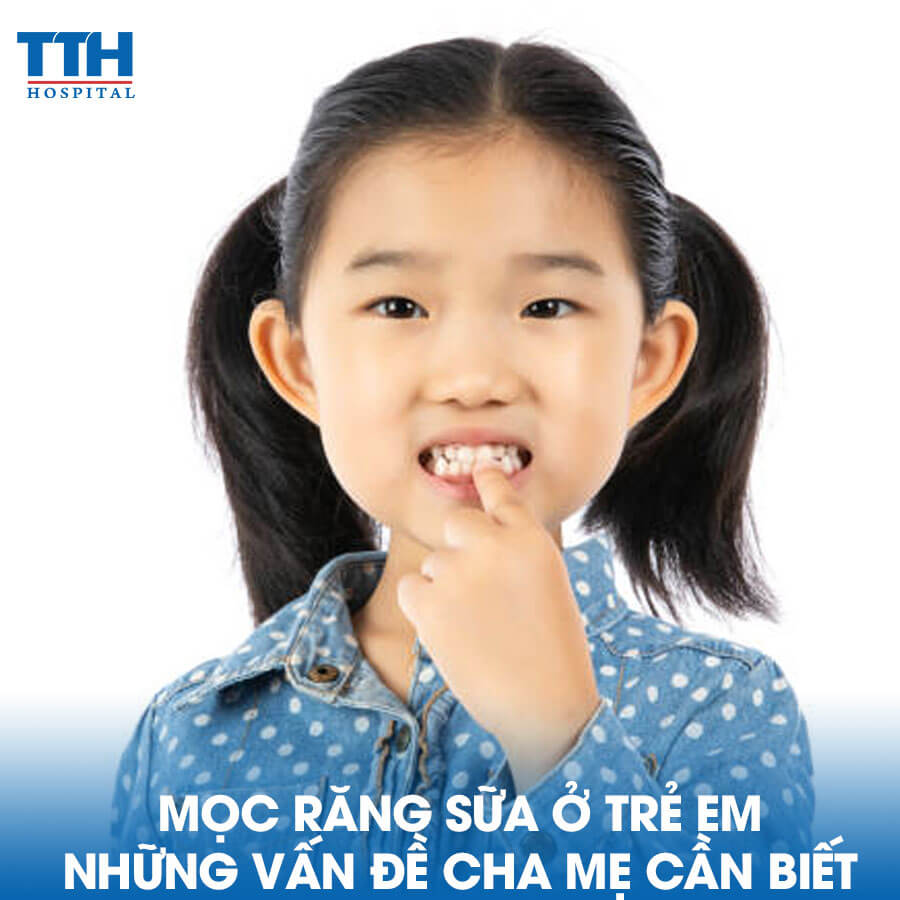 Mọc Răng Sữa ở Trẻ Em - Những Vấn Đề Cha Mẹ Cần Biết