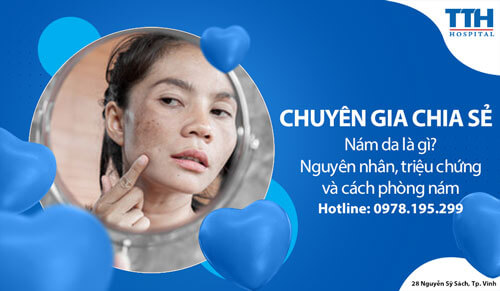Nám da là gì? Nguyên nhân, triệu chứng và cách phòng nám
