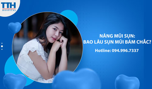 Nâng Mũi Sụn: Bao Lâu Sụn Mũi Bám Chắc?