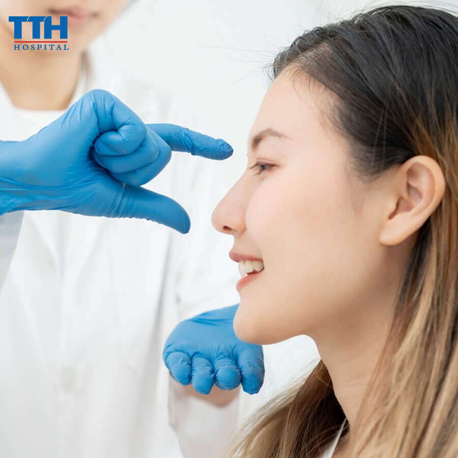 Nâng mũi sụn Surgiform là gì? Tất tần tật thông tin bạn cần biết