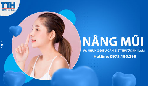 Nâng mũi và những điều cần biết trước khi làm