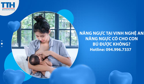 Nâng Ngực Tại Vinh Nghệ An: Nâng Ngực Có Cho Con Bú Được Không?