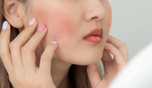 Nguyên Nhân Khiến Da Khô Ráp Trước Tết - Hiểu Rõ Để Chăm Sóc Hiệu Quả