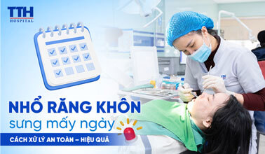 NHỔ RĂNG KHÔN SƯNG MẤY NGÀY?