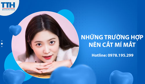 Những trường hợp nên cắt mí mắt