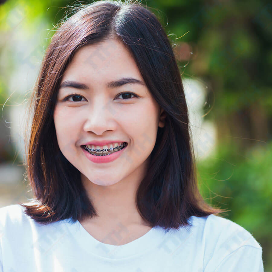 Niềng Răng Cho Trẻ Em: Khi Nào Là Thời Điểm Tốt Nhất?