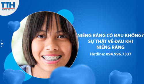 Niềng Răng Có Đau Không? Sự Thật Về Đau Khi Niềng Răng tại Vinh, Nghệ an
